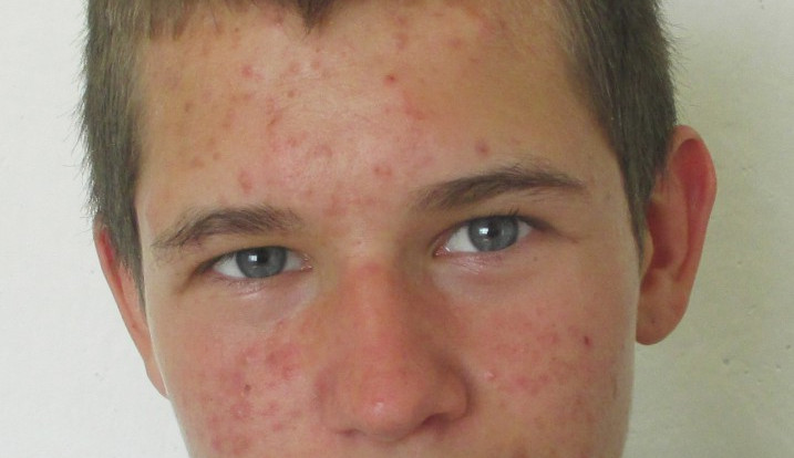 zdroj: PČR