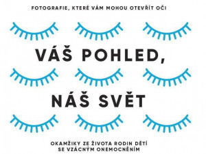 Jedinečná fotografická výstava o dětech se vzácnými chorobami bude k vidění v Pevnosti poznání