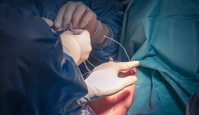 FOTO/VIDEO: Nová operační technika pomáhá ortopedům navrátit hybnost ramene