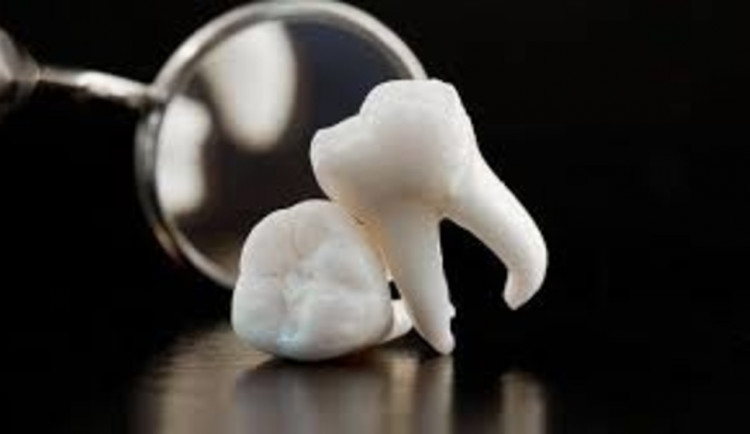 Chlapec spadl na koloběžce a vyrazil si zuby, které vyhodil do koše, policisté je našli a chlapci pomohli