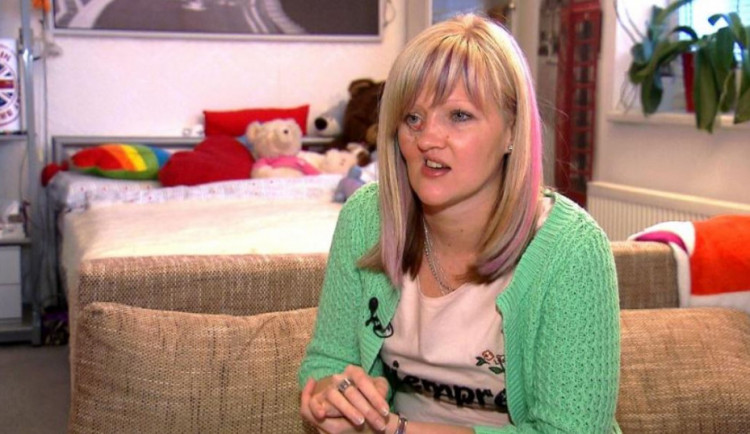 Olomoučanka shání peníze na náročnou operaci obličeje. Pojišťovna jí nepomůže