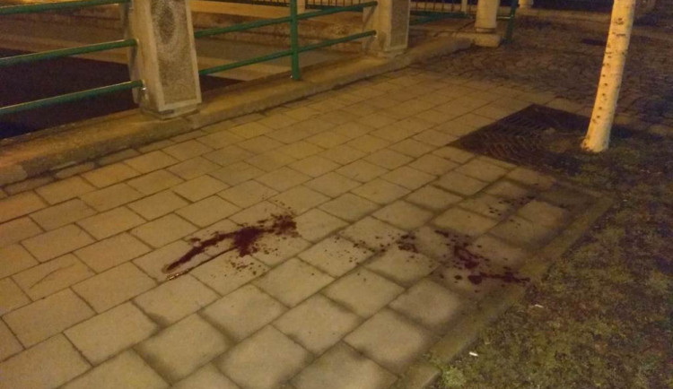 Muže v centru napadla  šestice cizinců, vyvázl s krvavým zraněním