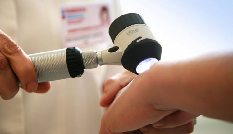 Lidé budou moci využít bezplatné vyšetření znamének a poradit se s odborníkem