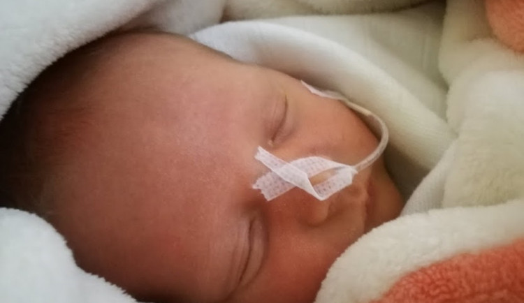 Ve šternberské nemocnici nově zajišťují péči o předčasně narozené děti