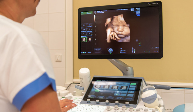 Videozáznam a 3D fotografii miminka si můžete odnést z Fakultní nemocnice Olomouc