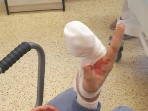 Chlapec ve skateparku přišel o část prstu. Do nemocnice ho vezli strážníci