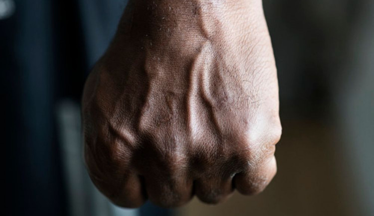 Osmnáctiletý útočník zaútočil u baru na muže teleskopickým obuškem, bil jej do hlavy