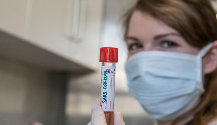 Jesenická nemocnice testuje na koronavirus i samoplátce. Cena testu jsou necelé tři tisíce