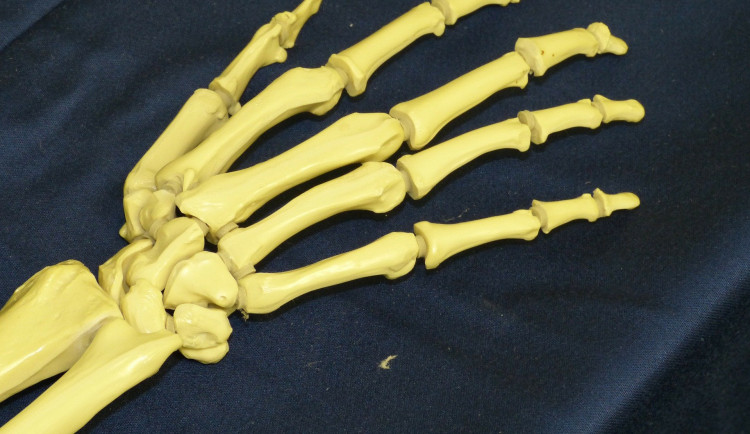 Děti našly ve Smetanových sadech vykopané kosti. Jedná se o lidské ostatky