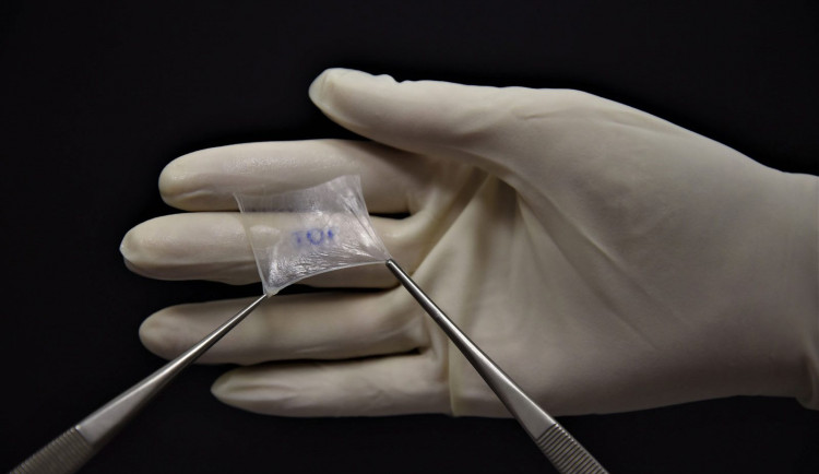 Vědci z Česka vyvinuli unikátní náplast, která pacientům pomůže zahojit chronické rány