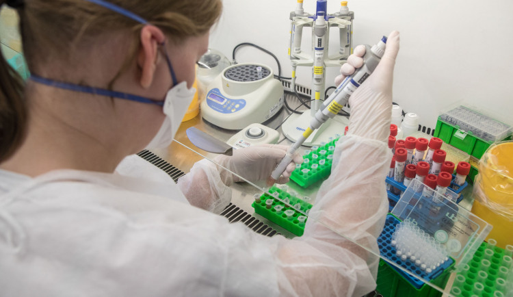 Jedna z úřednic na prostějovském magistrátu měla pozitivní test na koronavirus