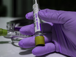 V sobotu přibylo 508 případů nákazy koronavirem, o volném dni dosud nejvíc