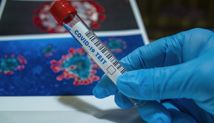 Vědci v Olomouci vyvinuli nový test na koronavirus. Výsledky prokáže do hodiny