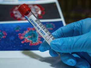 Vědci v Olomouci vyvinuli nový test na koronavirus. Výsledky prokáže do hodiny