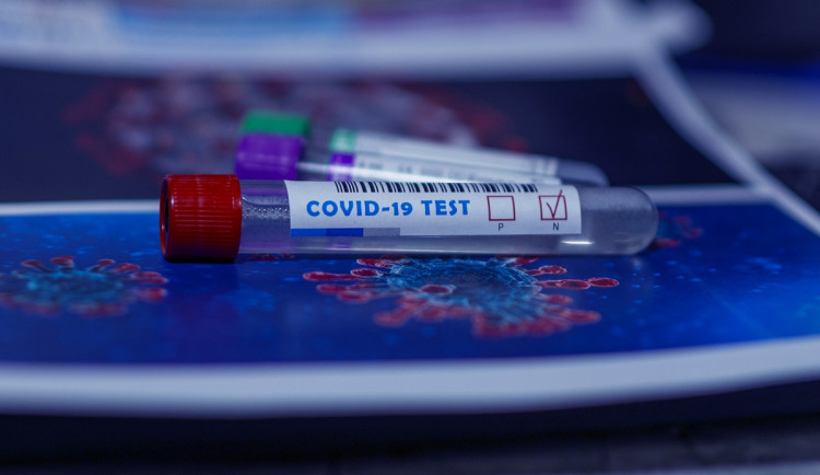 V Olomouckém kraji za týden přibylo 5570 nákaz koronavirem. Tempo růstu zpomalilo