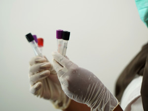 Prostějovská nemocnice ve své laboratoři ztrojnásobila testovací kapacitu