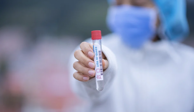 Plošné antigenní testování bude pokračovat i po 15. lednu