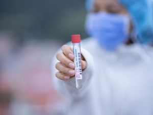 Plošné antigenní testování bude pokračovat i po 15. lednu